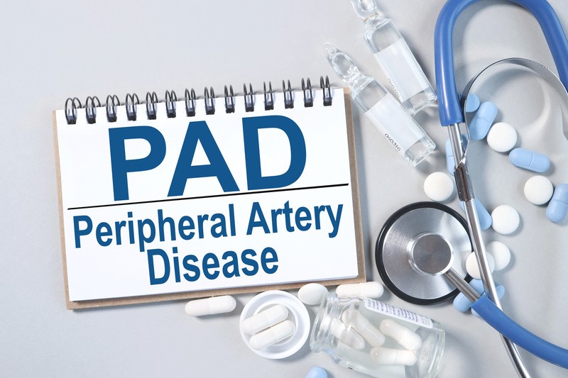 PAD - Peripheral Artery Disease, text on notepad