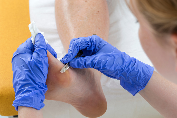 Diabetic Foot Care- Woman receiving podiatry treatment