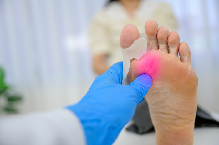 a podiatrist inspecting patient's foot for bunions
