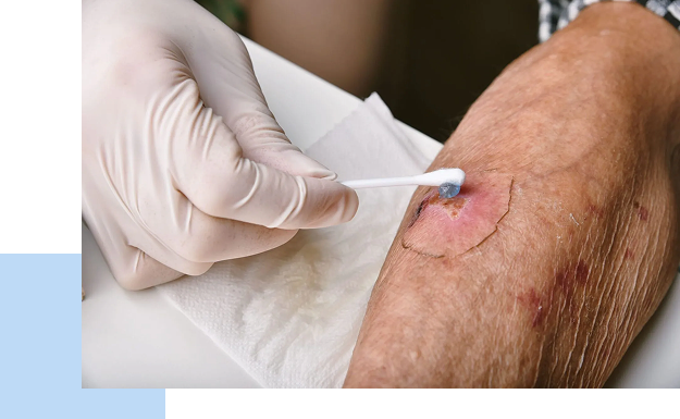 Wound Care